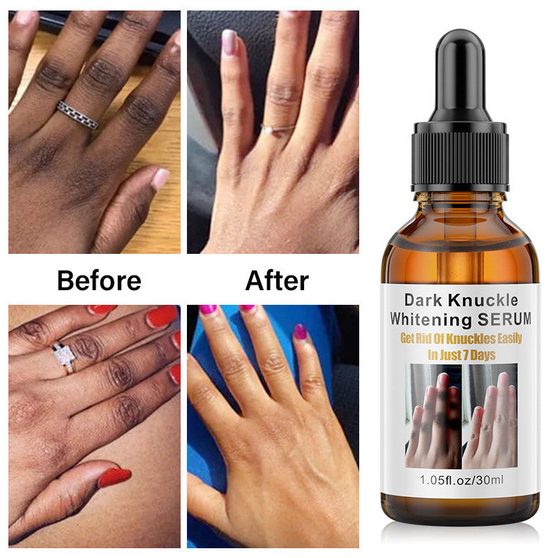 ✅Dark Knuckle Serum (100% Guarantee)